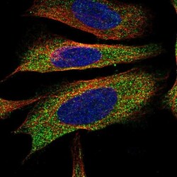 EPHX2 Antibody, Novus Biologicals:Antibodies:Primary Antibodies